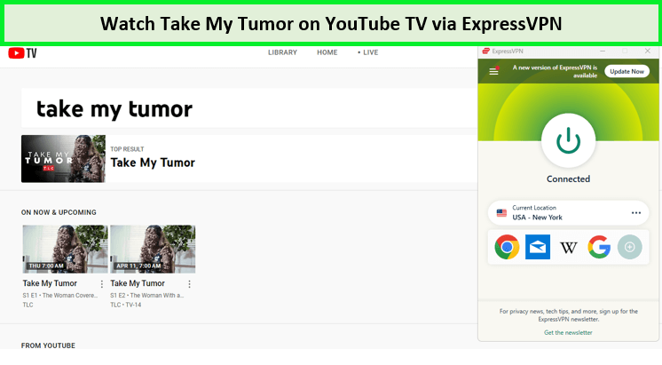 Watch-Take-My-Tumor-Season-1-outside-USA-on-YouTube-TV-with-ExpressVPN